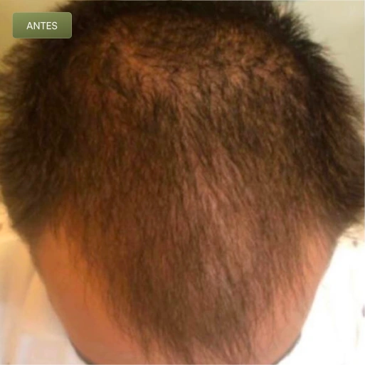 01 Antes-(Compressify.io)