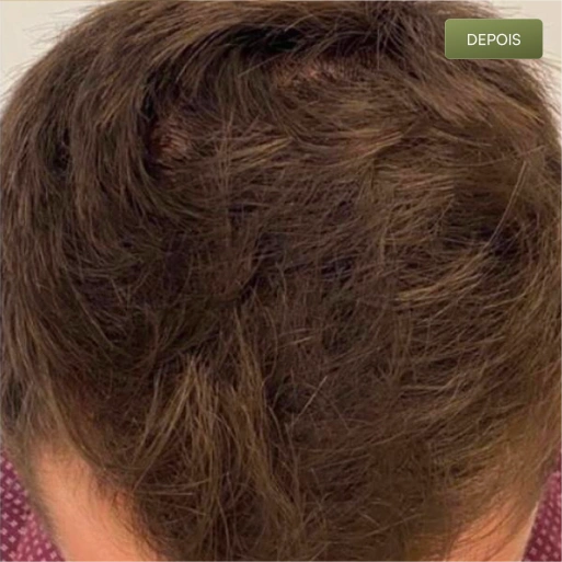 01 Depois-(Compressify.io)