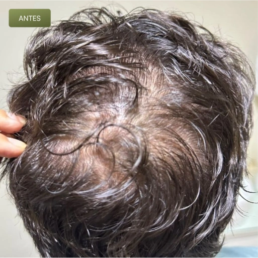 02 Antes-(Compressify.io)