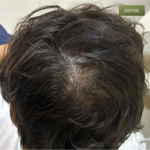 02 Depois-(Compressify.io)