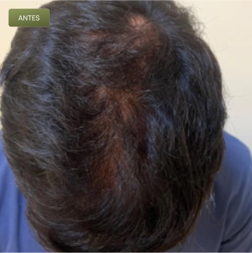 03 Antes-(Compressify.io)