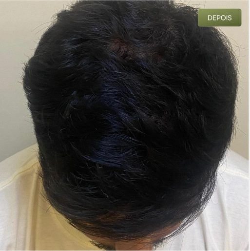 03 Depois-(Compressify.io)