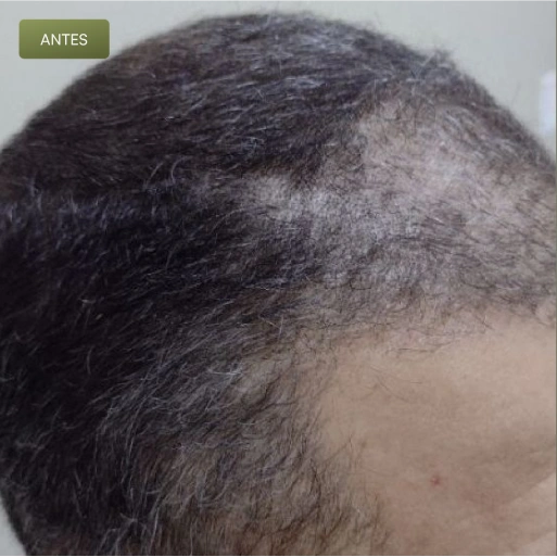 04 Antes-(Compressify.io)