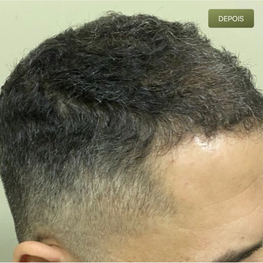 04 Depois-(Compressify.io)