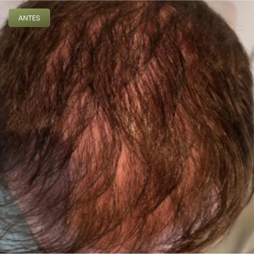 05 Antes-(Compressify.io)