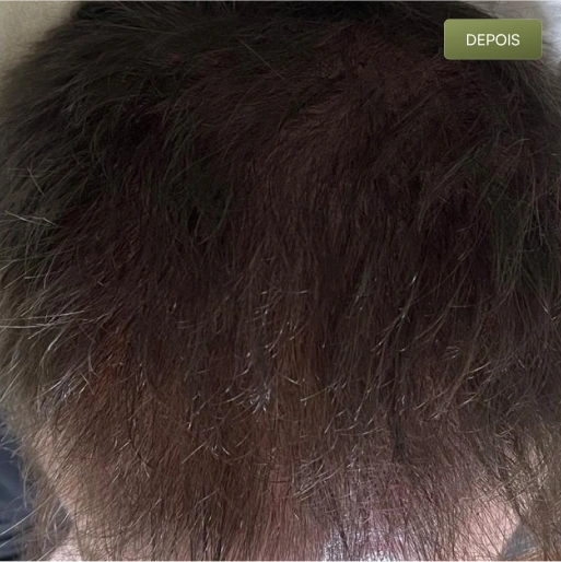 05 Depois-(Compressify.io)