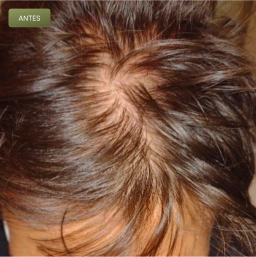 06 Antes-(Compressify.io)