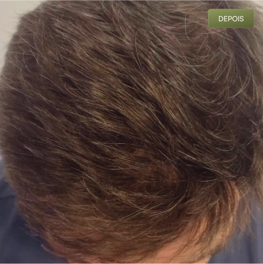 06 Depois-(Compressify.io)