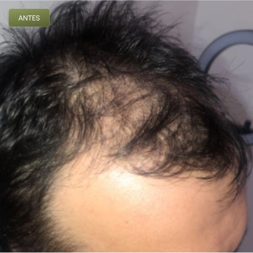 07 Antes-(Compressify.io)