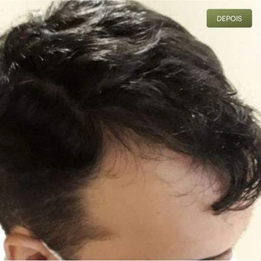 07 Depois-(Compressify.io)