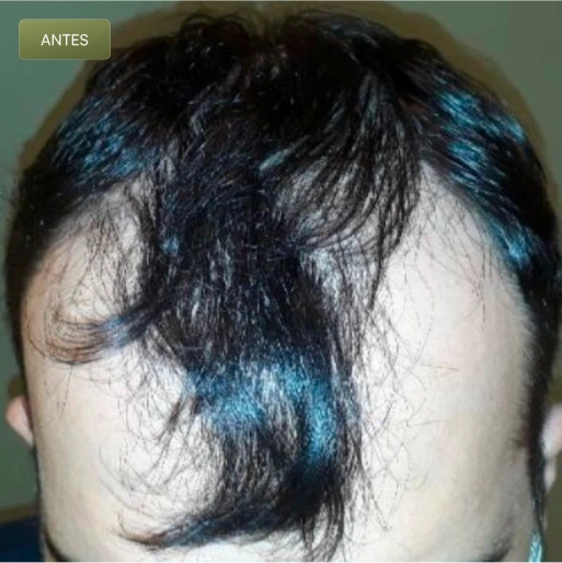 08 Antes-(Compressify.io)