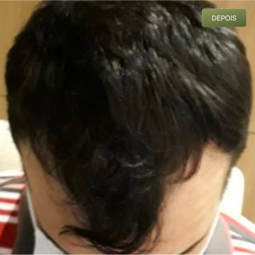 08 Depois-(Compressify.io)